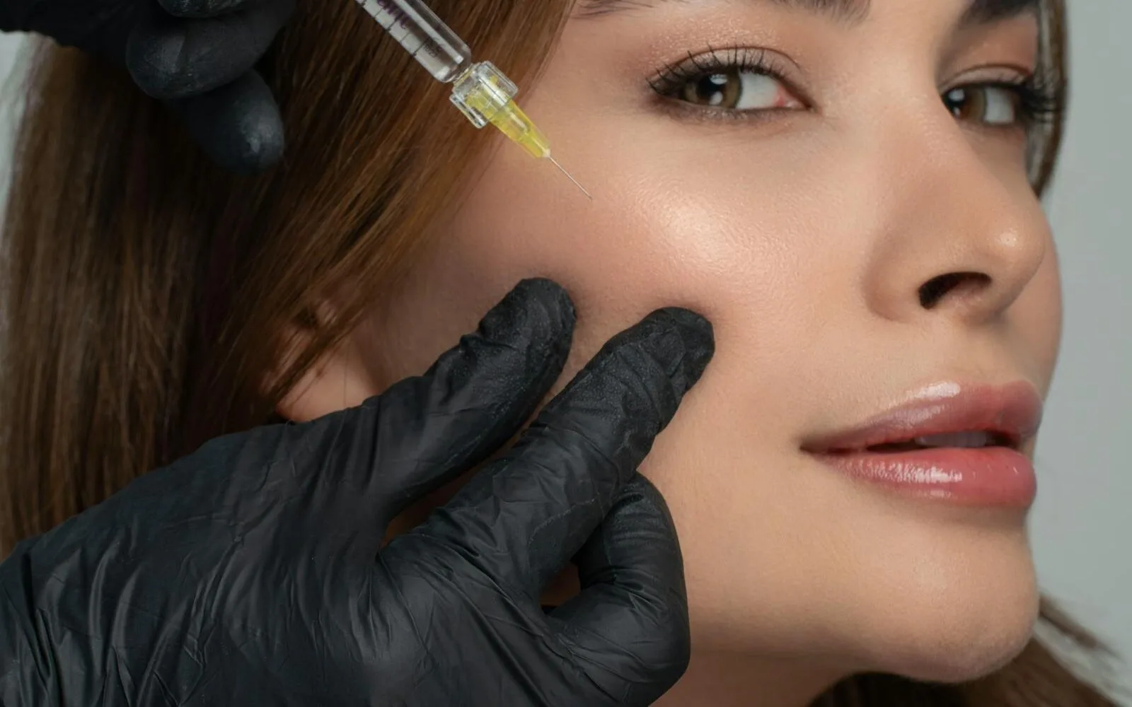 PRP Injections at Aesthetics Universe Med Spa in Anaheim, CA